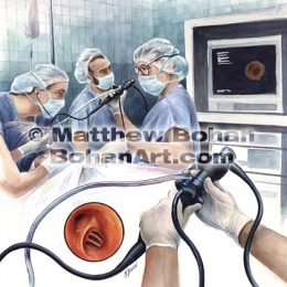Flexible Bronchoscopy (Transparent Watercolor) image available for license