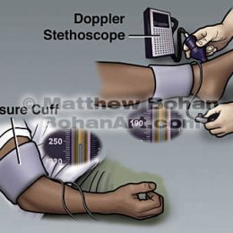Doppler Stethoscope (Photoshop)