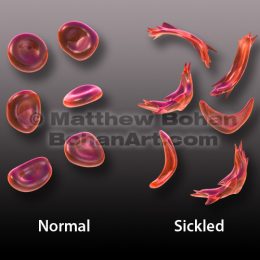 Sickle Cell (Lightwave 3d & Photoshop)  image available for license