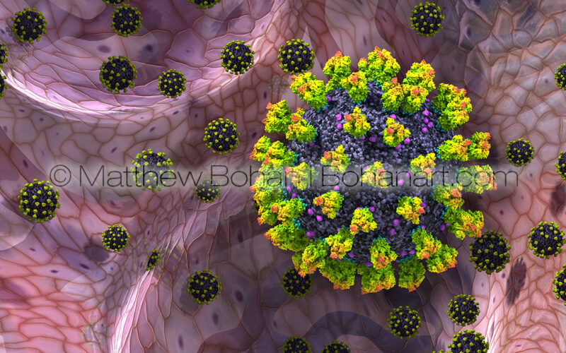COVID19 VIrus in Alveolus of Lung (Lightwave3d Photoshop)